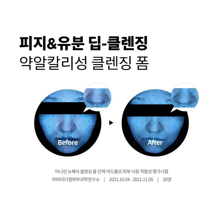 [피지감소] 이즈앤트리 어니언 뉴페어 클렌징폼 150ml 상세페이지 6